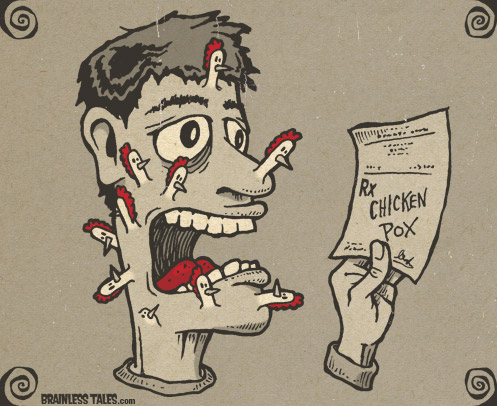 Chicken Pox
